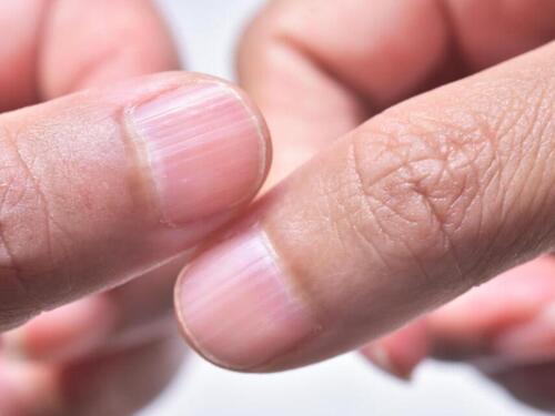 Đàn ông có thận khoẻ sẽ không bị đen ở 3 bộ phận này