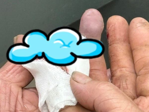 Bức ảnh chụp bàn tay cụ ông đi viện khiến hàng triệu người nức nở