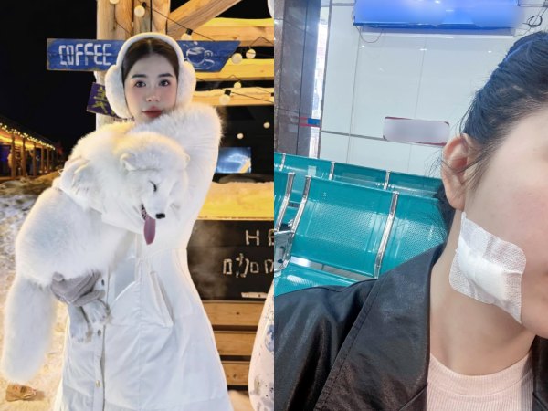 Bức ảnh dấy lên lo ngại cho Hằng Du Mục sau thời gian 'mất tích'