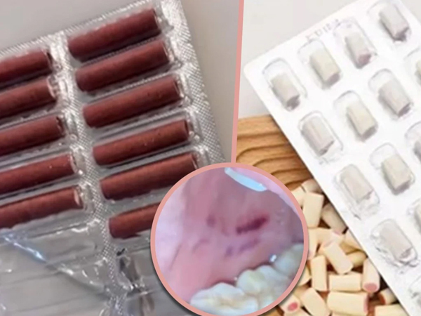 Cô gái bị viên pháo nổ ngay trong miệng vì tưởng nhầm là kẹo sữa