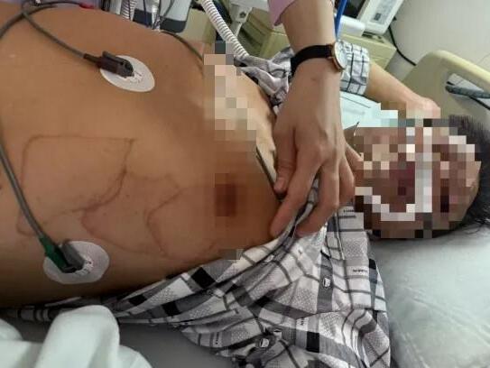 Người đàn ông ngừng tim 10 phút, cận kề 'cửa tử' vì một sai lầm cực hại tim khi tập thể dục