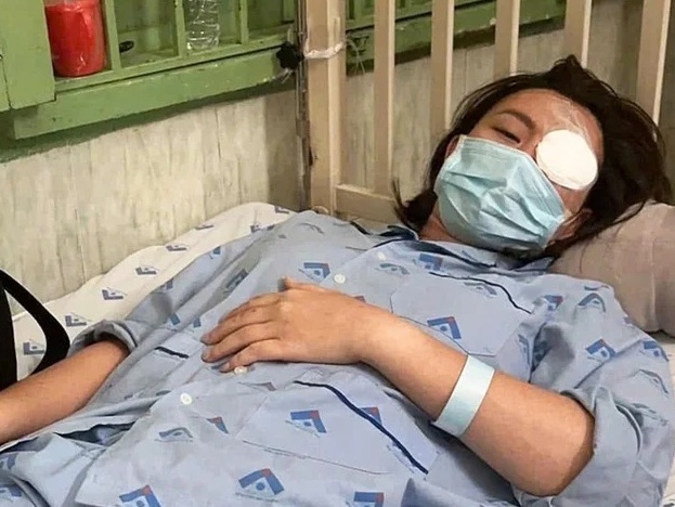 Vụ cô gái bị đánh vỡ xương hốc mắt: Hẹn kết thúc quan hệ thì bị đánh dã man tại quán cà phê