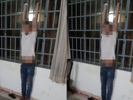 Truy tố cựu thượng úy và dân phòng xã dùng nhục hình ở Đồng Nai