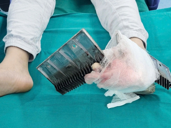Bé trai bị kẹp chân vào thang cuốn trung tâm thương mại