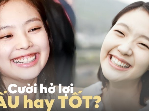 Cười hở lợi trong trong nhân tướng học dự báo điều gì về vận mệnh?