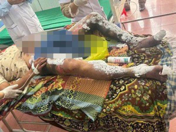 Người đàn ông bị bỏng nặng vùng kín nằm bất tỉnh ven đường, nghi do sạc dự phòng phát nổ