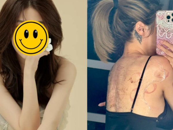 Sao nữ Vbiz đang điều trị trầm cảm: Cập nhật tình hình sức khỏe đáng chú ý