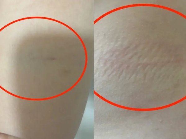 Cô giáo bị tố đánh, xưng 'ông - tui' với học sinh lớp 2 ở Nha Trang