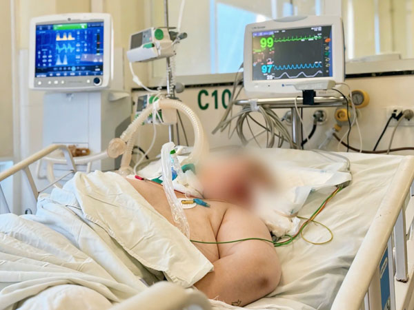 Mổ não cấp cứu người phụ nữ trẻ sau bữa nhậu