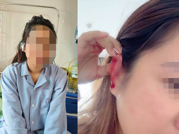 Hà Nội: Cô gái cầu cứu sau khi bị bạn cùng phòng trọ hành hung rách tai vì lấy nhầm nồi nấu ăn