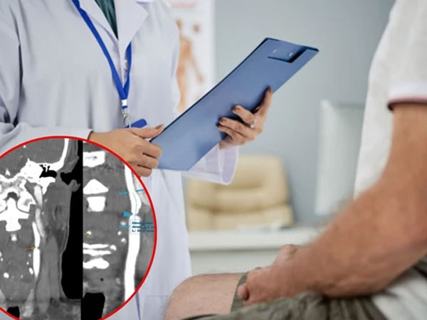 Tình cờ làm điều này, người đàn ông Hà Nội 'thoát' đột quỵ trong gang tấc