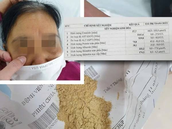 Cụ bà 70 tuổi suy thận cấp vì dùng thuốc mua qua mạng