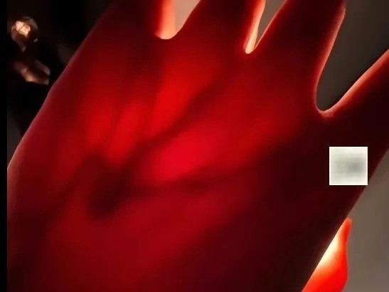 Cô gái đăng ảnh mình chiếu đèn pin vào tay, cư dân mạng phát hiện điều bất ổn