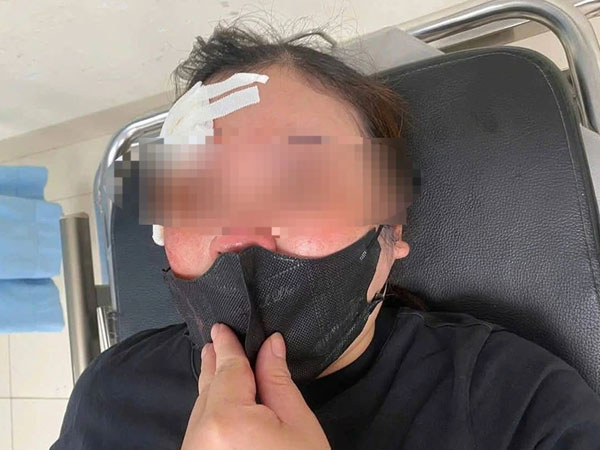 Người phụ nữ ở Hà Nội 'tố' bị tài xế đi ô tô vụt dùi cui vào đầu