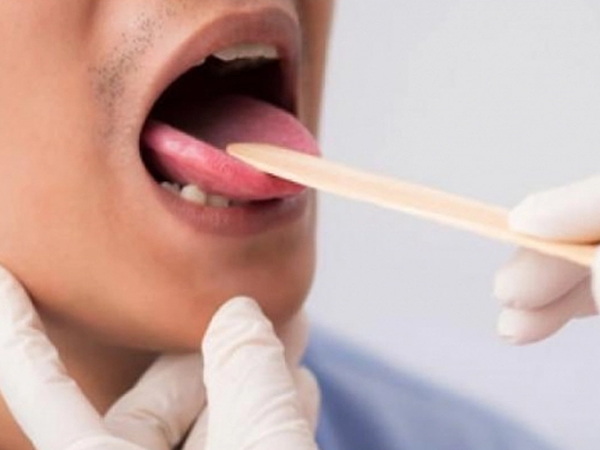 Đừng bỏ qua 'vết lạ' trong miệng, có thể đó là lời cảnh báo về loại ung thư cực nguy hiểm
