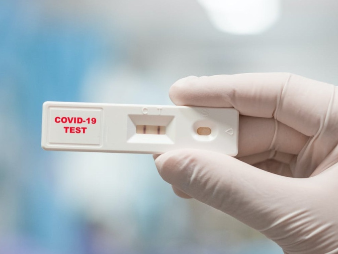 Có triệu chứng Covid-19 có cần test nhanh? Chuyên gia nêu ý kiến