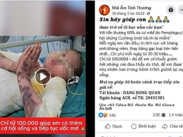 Người bệnh mang tiếng oan vì có kênh chạy quảng cáo kêu gọi từ thiện vào tài khoản lạ