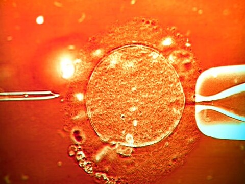 Hàng chục trẻ em sinh ra từ tinh trùng người mang gene ung thư, 10 trẻ mắc bệnh