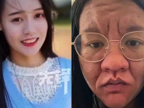 Biến đổi 'sốc' trên khuôn mặt mẹ trẻ khi mang thai: Từ 'rạng rỡ' bất ngờ đến khó nhận ra chính mình trong gương