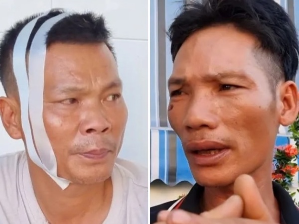 Tai nạn trên cao tốc 18 người thương vong: 'Tôi run chân bước qua hiện trường đầy ám ảnh'