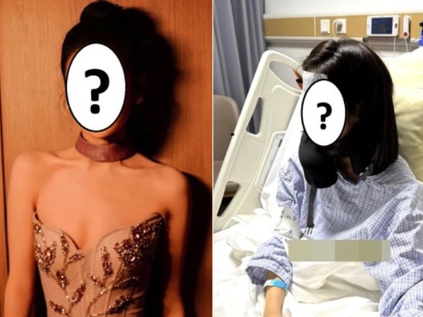 Một nữ diễn viên hạng A phải cắt bỏ túi mật vì sỏi mật, túi mật mất chức năng