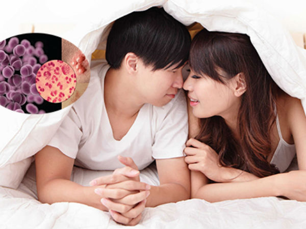 Quan hệ tình dục không an toàn gieo rắc bệnh lậu khắp thế giới