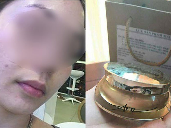 Khách hàng từng là đại lý của TS Group tố bị mẩn ngứa khi dùng sản phẩm: "Bây giờ liên hệ với họ như đi mò kim đáy bể"