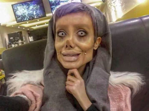 Bị dân tình ném đá dữ dội, cô gái phẫu thuật giống Angelina Jolie chính thức lên tiếng 'phản pháo'