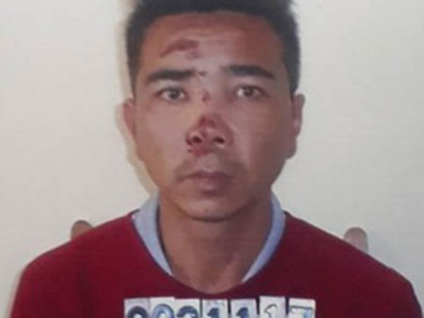 Thanh Hóa: Ghen tuông, đâm trọng thương người tình bằng dao