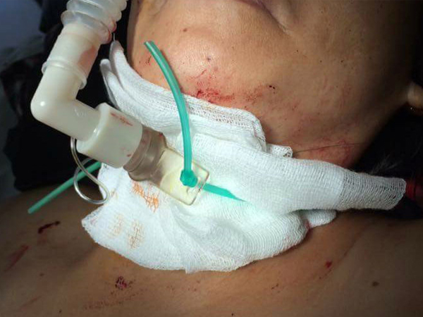 Vụ bà chủ tiệm tóc bị cắt cổ: Gây án xong, nghi phạm bình thản đi nghe ngóng