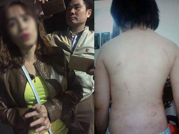 Người mẹ bé trai 10 tuổi bị bố bạo hành đến gãy xương sườn: 'Tôi không nhận ra con'