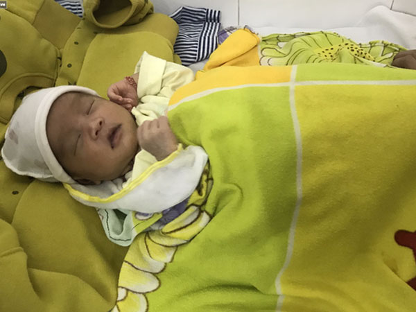Nhỏ sữa chữa đau mắt, mẹ chết lặng vì con thủng giác mạc, nổi bong bóng mắt