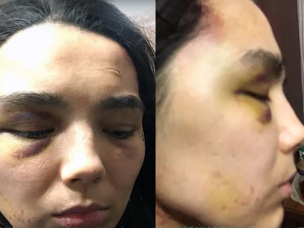 Hẹn hò qua mạng, cô gái cả tin bị biến thành nô lệ tình dục, suốt 6 năm không được nhìn thấy ánh mặt trời