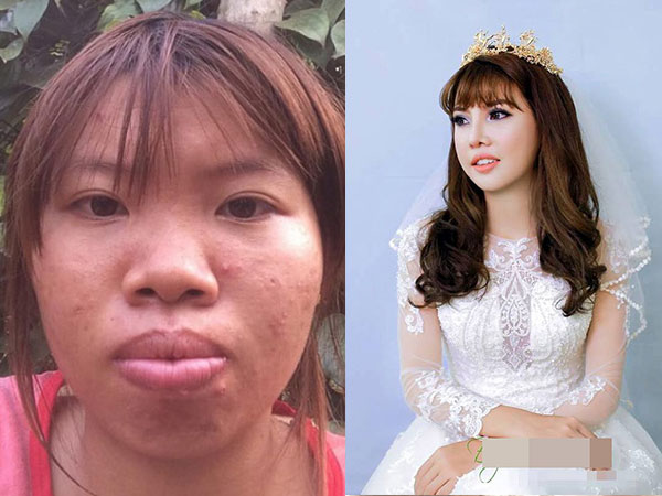 “Thị Nở tái sinh” sắp tái hôn với trai tân 28 tuổi