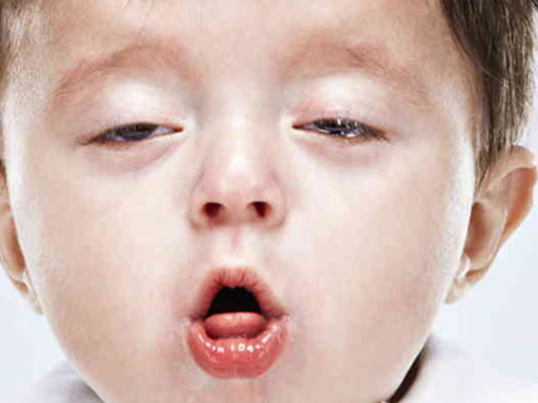 Mẹo chữa ho cho trẻ không cần dùng thuốc