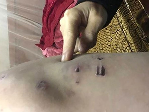 Vụ bé trai 9 tuổi bị bạo hành tại Đông Anh: Bố, mẹ ký đơn hòa giải