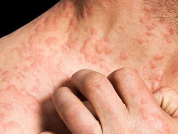 Gan có thể đang kêu cứu nếu cơ thể xuất hiện các dấu hiệu này