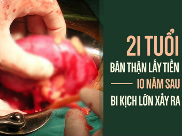Bán thận vì không coi nó là gốc của sự sống, ai làm tốt 4 việc này thì thận mới 'bền'