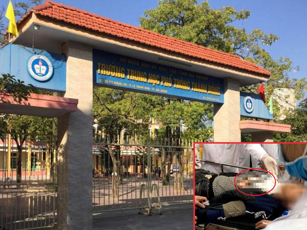 Lộ nguyên nhân vụ nam sinh ở Hải Dương bị đâm nguy kịch