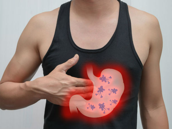 Phó giáo sư Mỹ chỉ rõ 6 dấu hiệu không gây đau nhưng cảnh báo sớm bệnh ung thư dạ dày