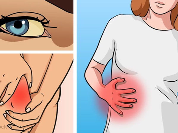 6 dấu hiệu cảnh báo gan của bạn có thể đang... bị hỏng