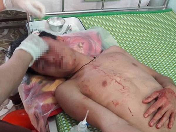 Nghệ An: Nhóm thanh niên vào trường hành hung thầy giáo và học sinh