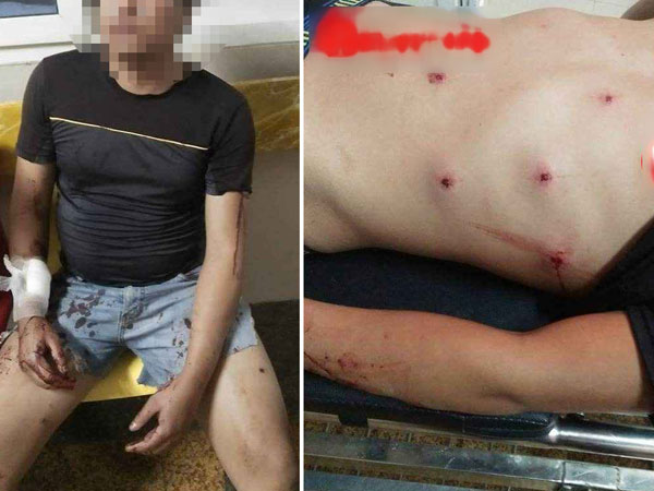 Bị truy đuổi, 'cẩu tặc' rút súng bắn 2 người dân nhập viện