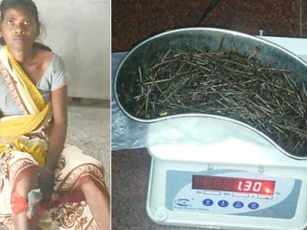 Chụp X-quang, bác sĩ phát hiện nhiều vật lạ trong chân cô gái và không thể tin nổi khi lấy ra