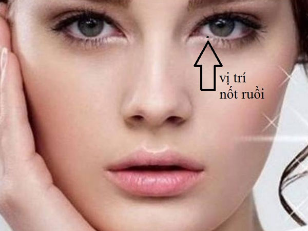 Khám phá ý nghĩa đặc biệt của nốt ruồi mọc trong mắt