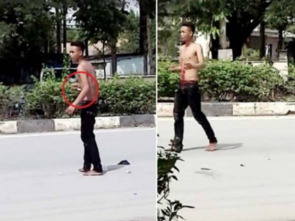 Nam thanh niên nghi 'ngáo đá' tự đâm xổ ruột giữa đường