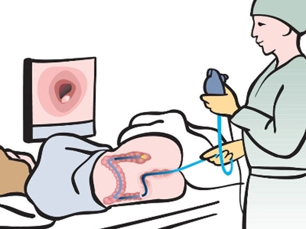 Hai xét nghiệm giúp loại bỏ sớm tế bào ung thư