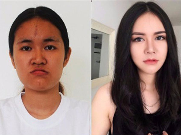 Nữ sinh Thương mại 'miệng móm da đen' lột xác không ngờ