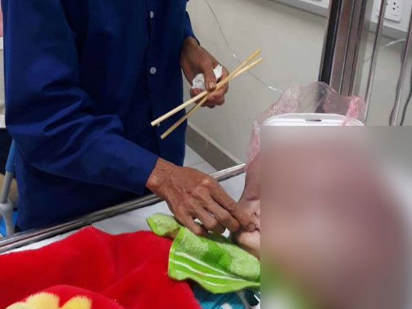 Bé trai 13 tháng tuổi chịu đau đớn từng ngày vì đầu to, mặt 'không giống ai'