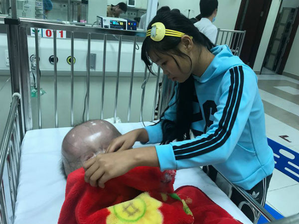 Mẹ của bé trai sinh ra có đầu to như quả bóng: "Chồng và gia đình chồng đều bỏ mẹ con tôi"